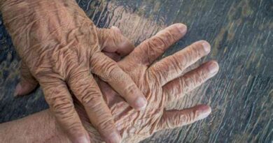 10 domande a risposta multipla sull’argomento: l’OSS e il paziente con Alzheimer
